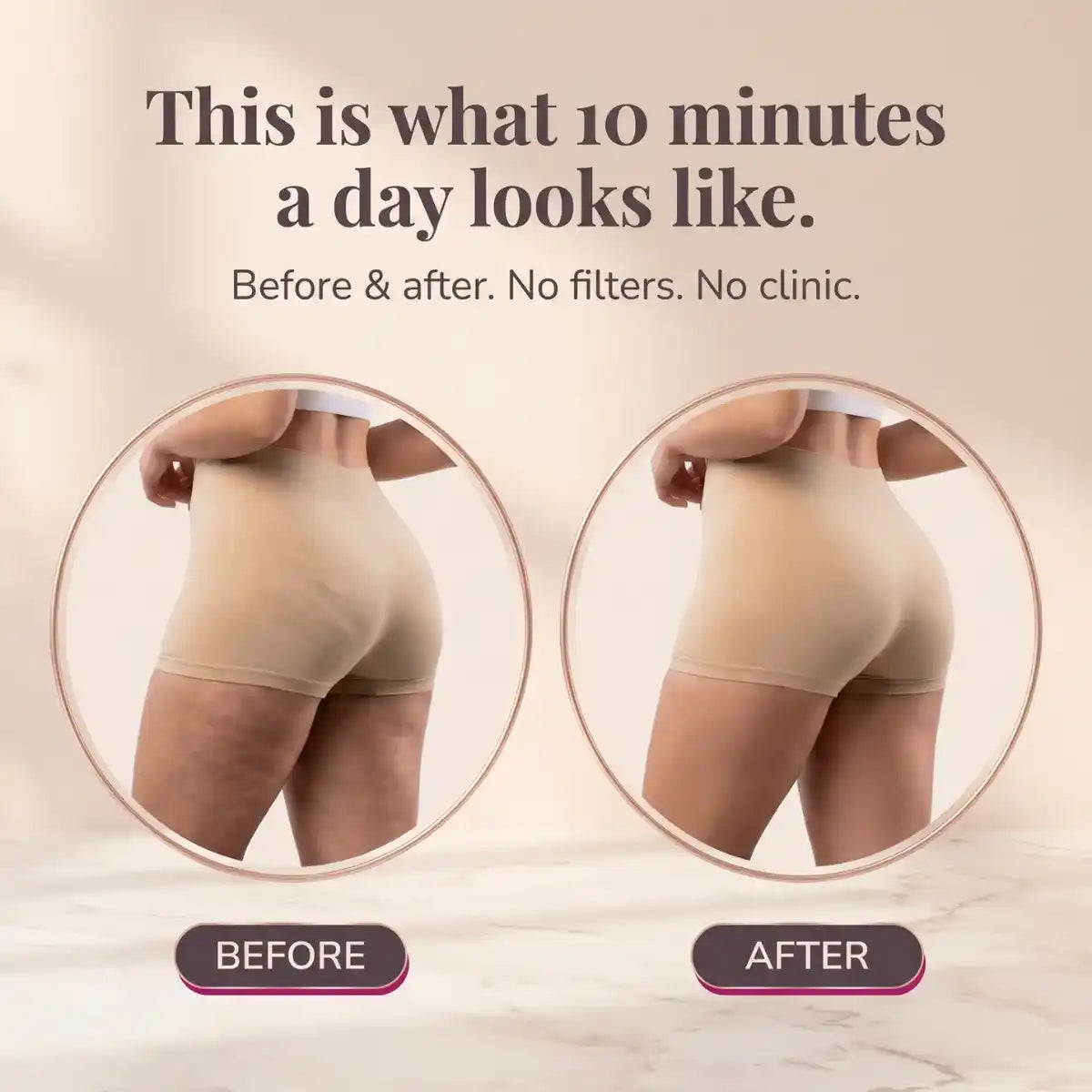The "Leg Upgrade" Sculptor