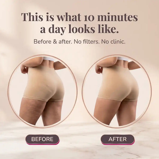 The "Leg Upgrade" Sculptor